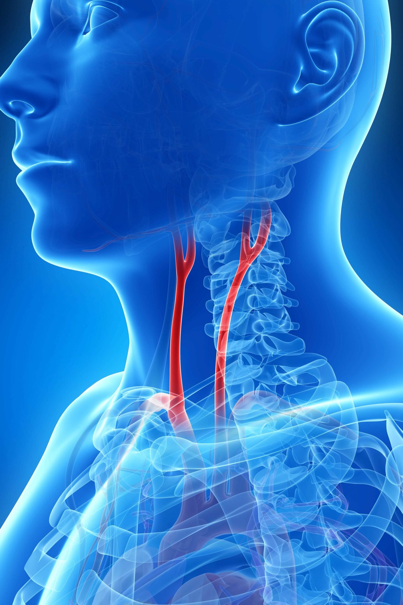 Şah Damarı Tıkanıklığında (Karotis Arter Hastalığı) Son Gelişmeler – 2024–2025