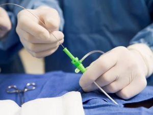Endovasküler ve Transkateter Girişimsel Tedaviler
