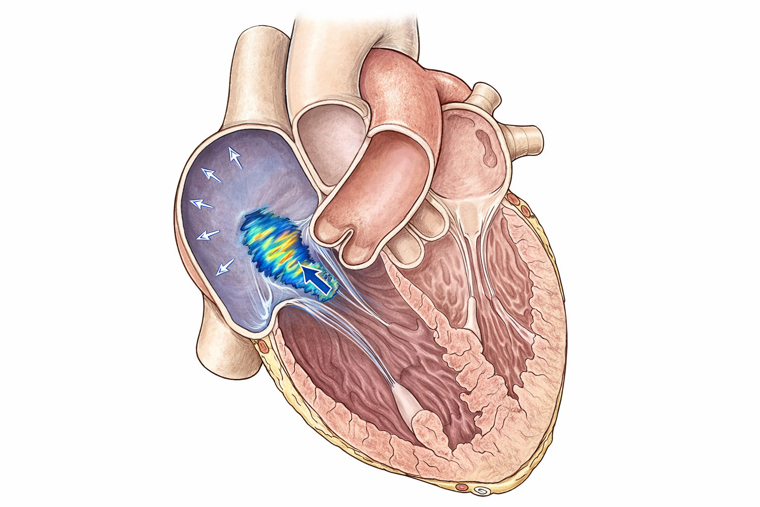 Triküspit Kapak Hastalıkları